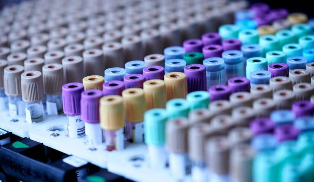 Labcorp betaalt boete en verbetert databeveiliging na datalek